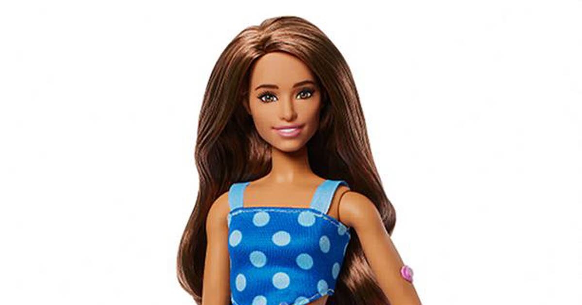 Gesellschaft. „Spielen inklusiver gestalten“: Mattel präsentiert die erste Barbie mit Diabetes