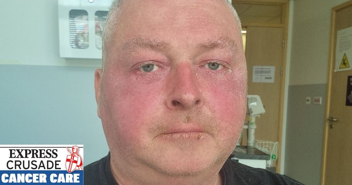 Jako pacjent chory na raka mam jedno pytanie do NHS w sprawie dziwacznych praktyk w szpitalach