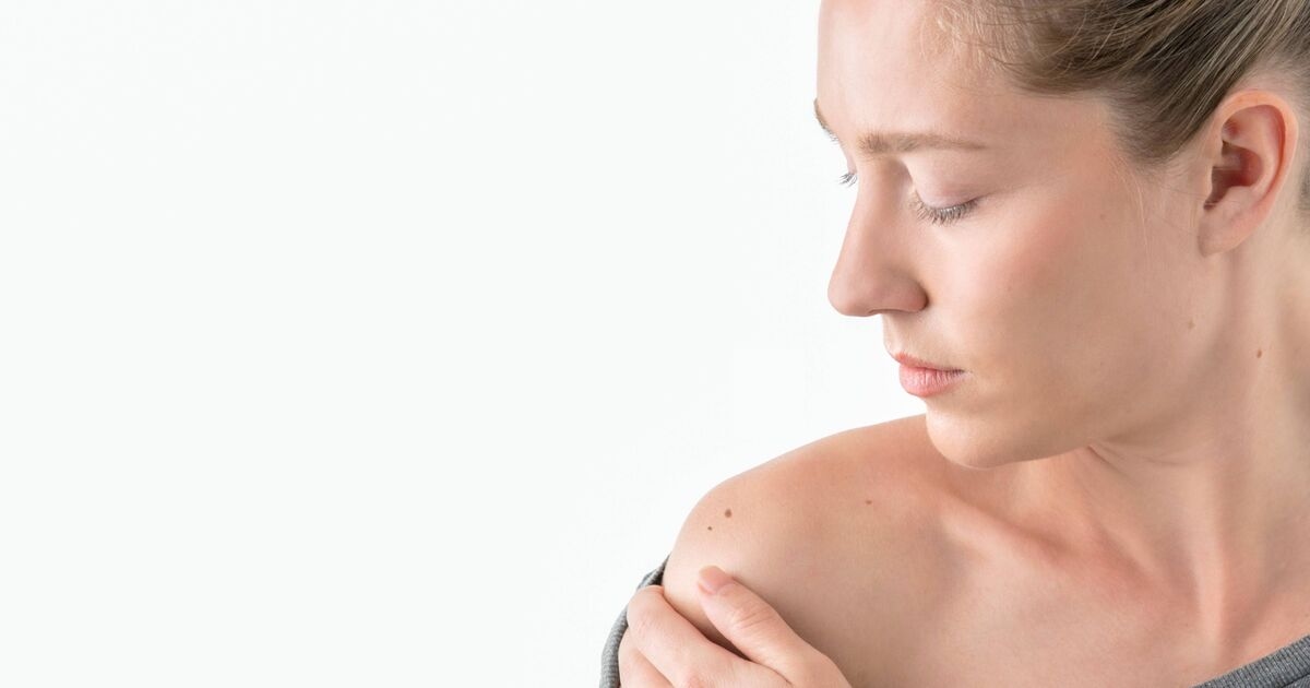 La "regla" de las manchas en la piel, según un dermatólogo, indica el momento de consultar al médico.