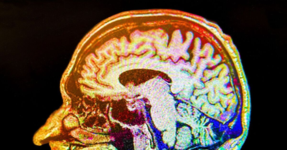 Evitar una bebida puede reducir el riesgo de Alzheimer y demencia