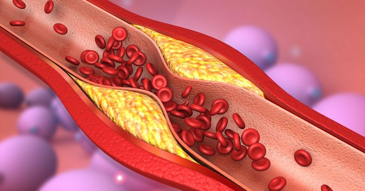 Cholesterol superfood that unclogs arteries is 'better than aspirin' doctor says
