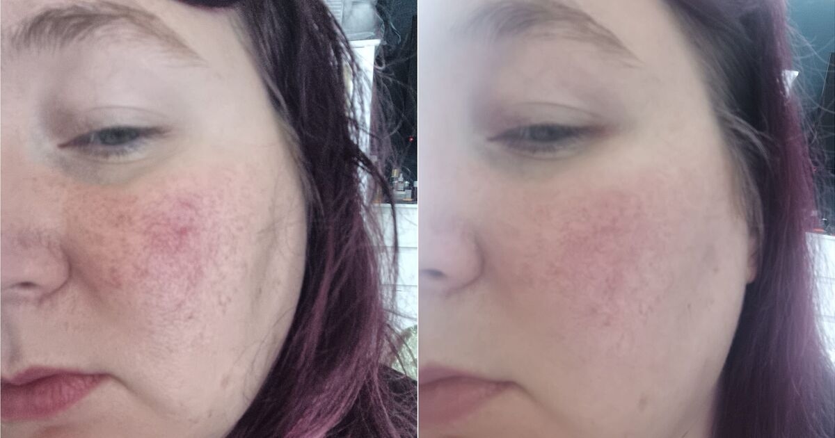 Ich habe eine Creme ausprobiert, die versprach, Rötungen zu reduzieren – sie hat tatsächlich noch etwas anderes bewirkt