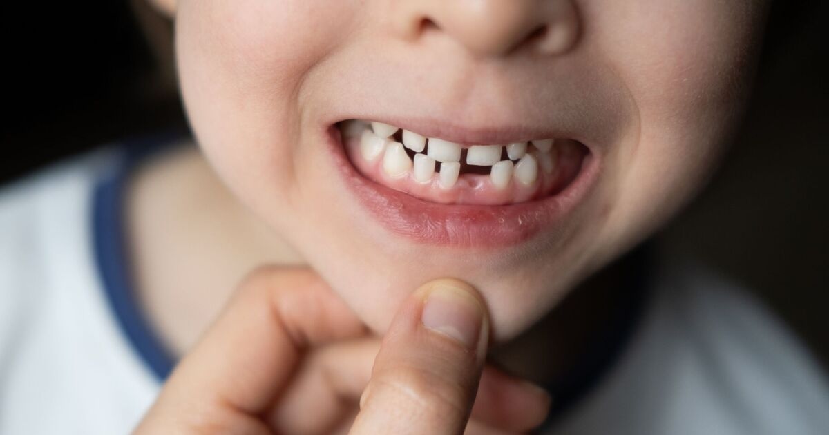 Sono un dentista: non ignorare mai questi sintomi nei bambini