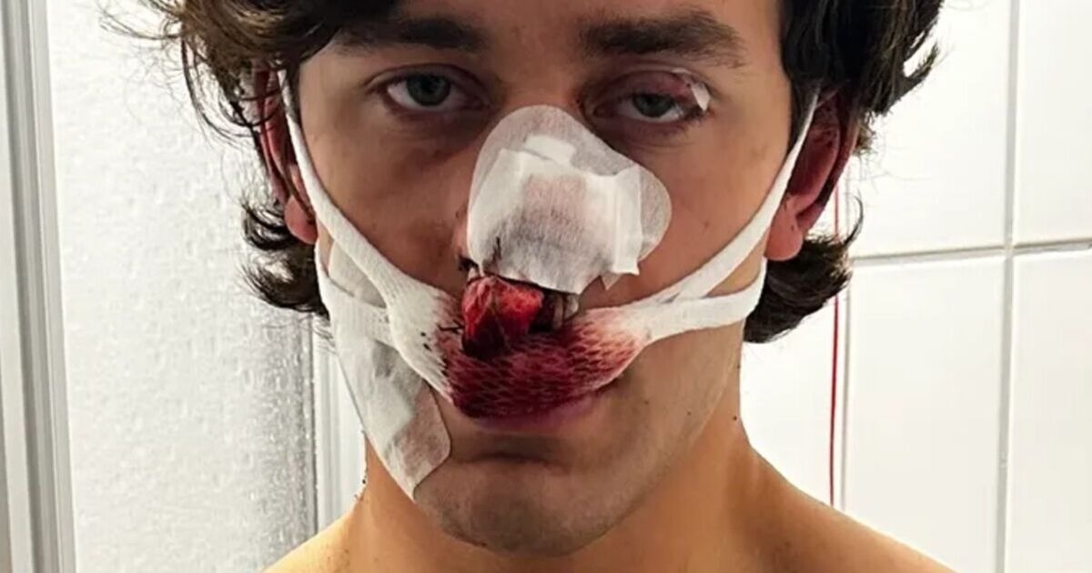 Tourist stabbed while defending two women slams Europe's ‘immigration problem'