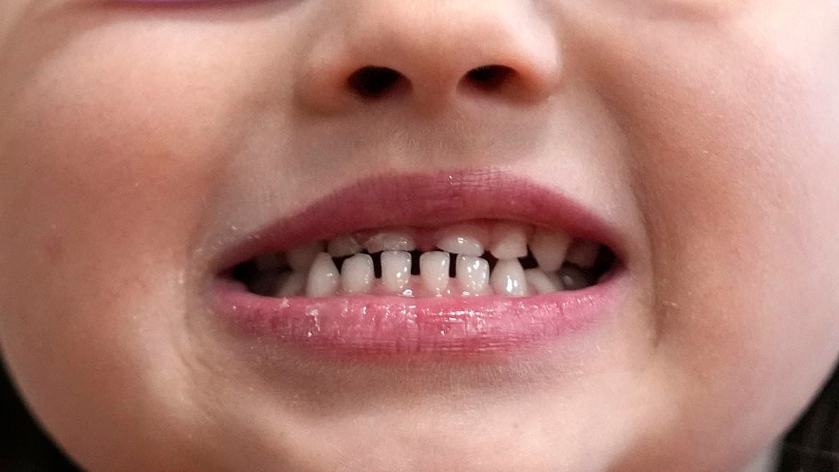FDA podejmuje działania mające na celu zakazanie popularnych suplementów z powodu obaw, że powodują USZKODZENIA MÓZGU