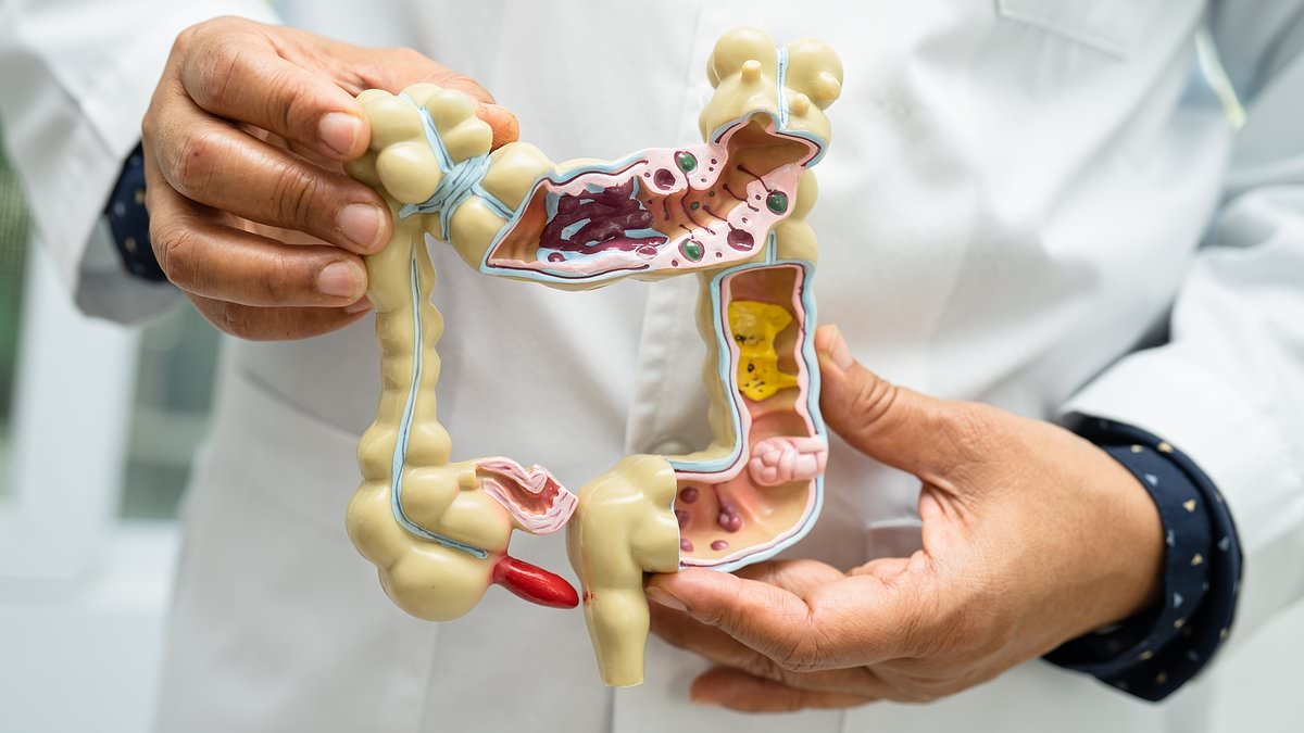 REVEALED: The one thing you can do for your child to slash their odds of bowel cancer in later life
