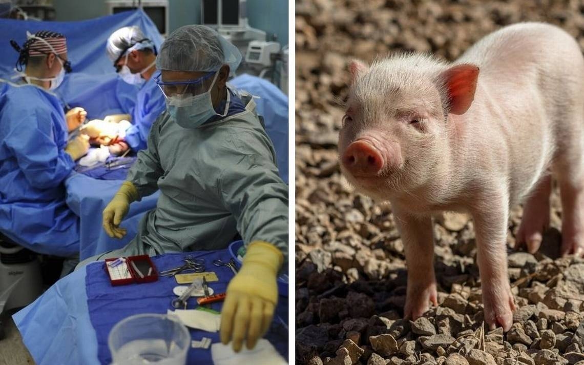 China führt erste Lungentransplantation von Schwein auf Mensch nach Hirntod durch