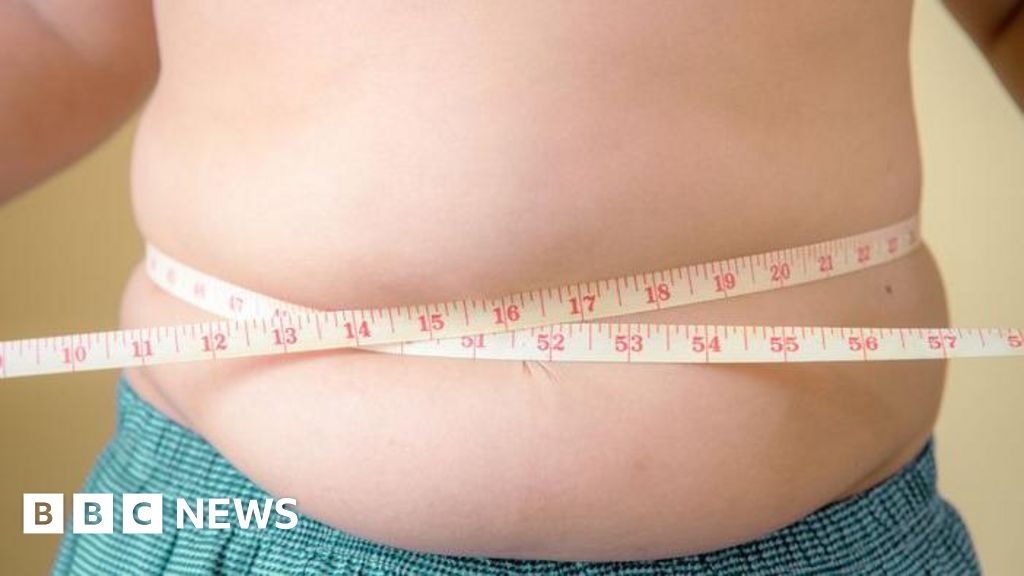 Mais crianças são obesas do que abaixo do peso, diz Unicef