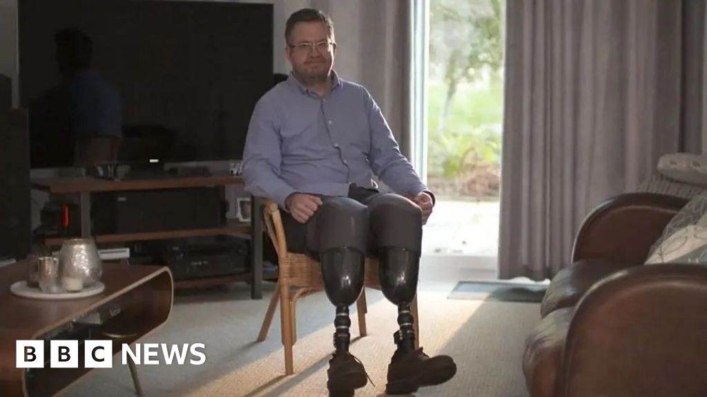 Surgeon jailed after amputation of own legs