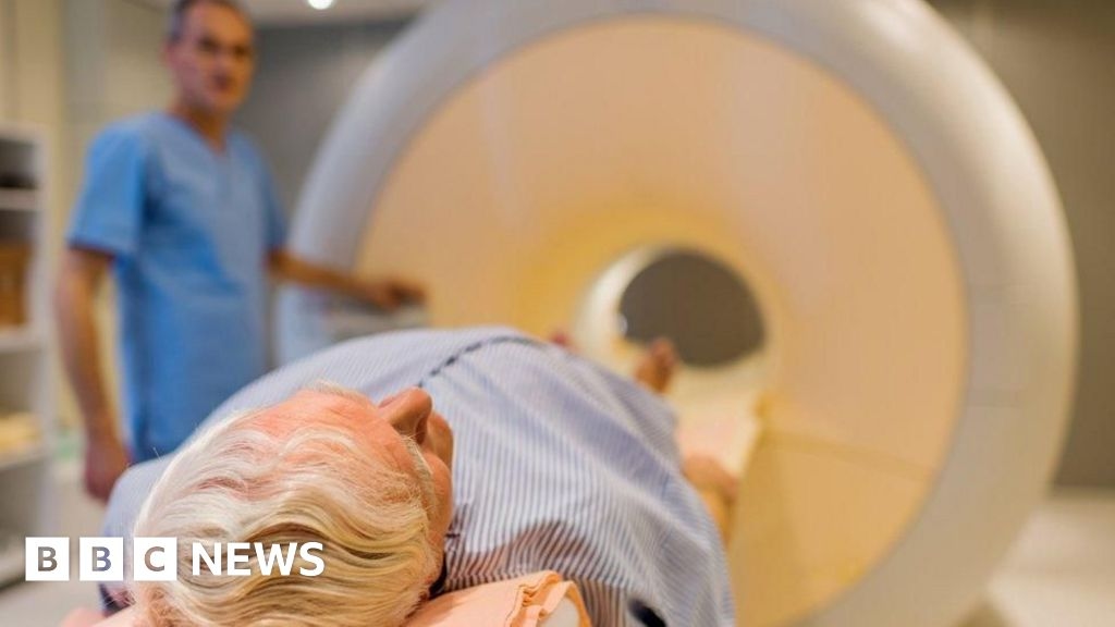 Secondo un'organizzazione benefica, gli uomini vengono trattati eccessivamente per il cancro alla prostata