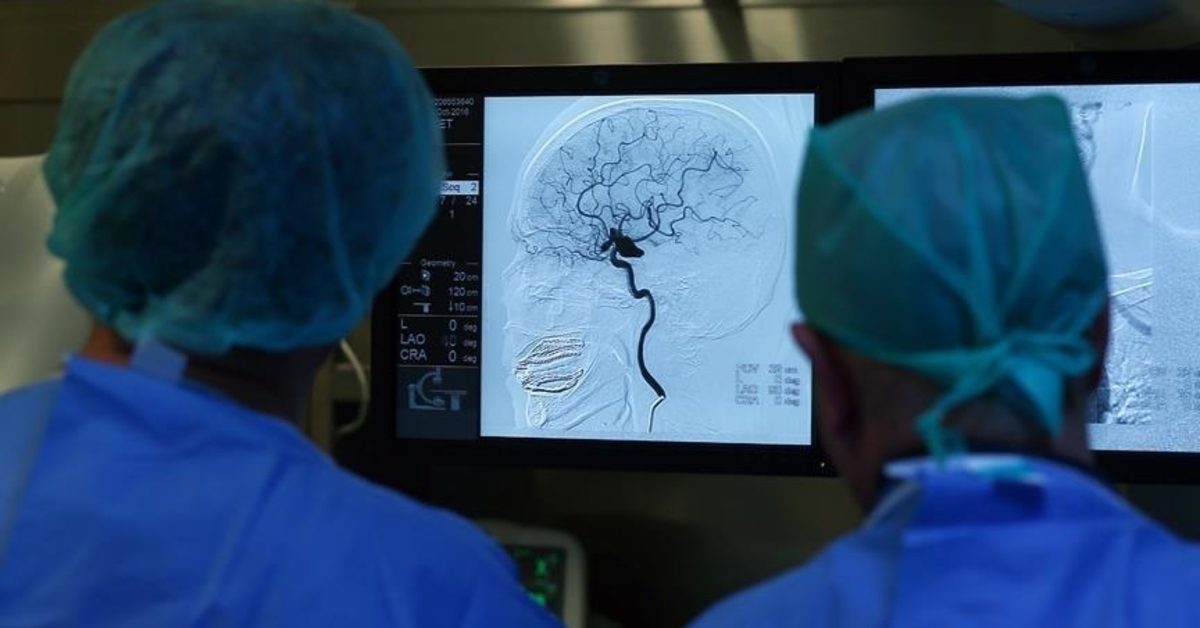 Un traitement et une réadaptation précoces réduisent le risque de séquelles permanentes après un AVC