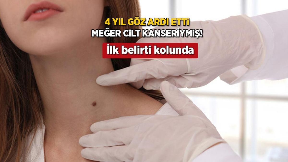 Przez 4 lata nic go to nie obchodziło, aż zachorował na raka! Jego pierwszym znakiem jest kropka: „Zabrano mi część ręki”
