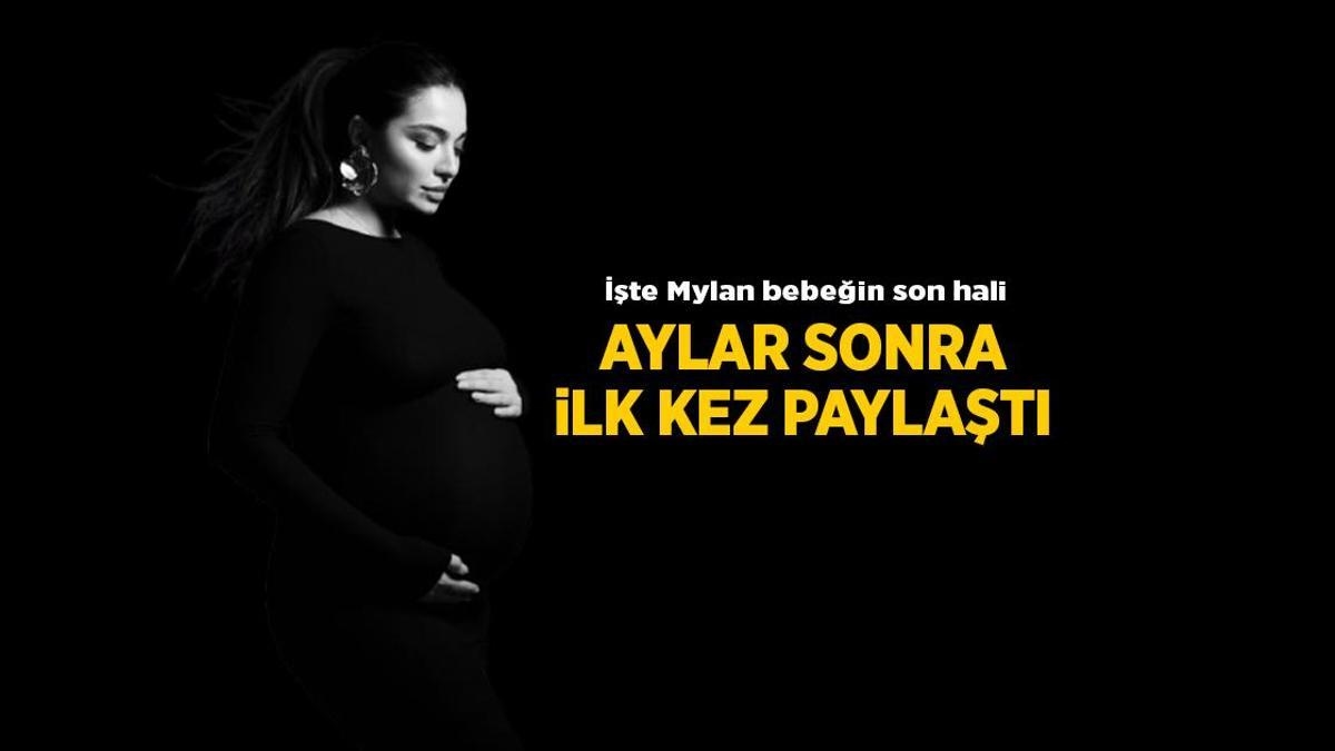 Haberler: Melisa Aslı Pamuk'un bebeği Mylan'ın son haline bakın
