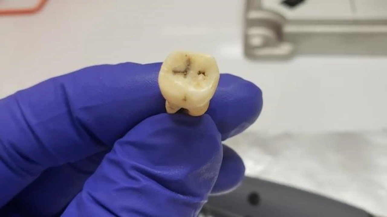 The bacteria responsible for the Justinian Plague, the first recorded pandemic in history that struck the Byzantine Empire, has been discovered.