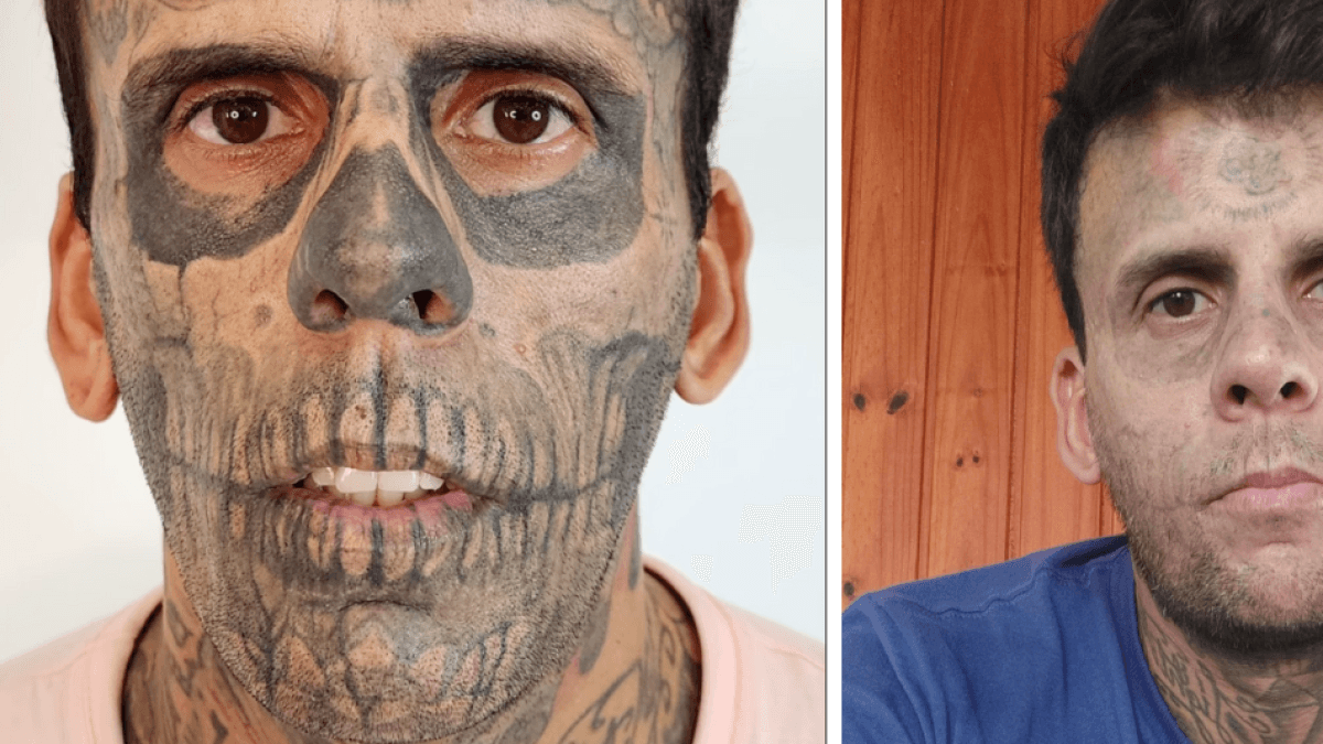 Leandro de Souza, el hombre más tatuado de Brasil, decidió quitarse los diseños: 'El dolor es horrible'