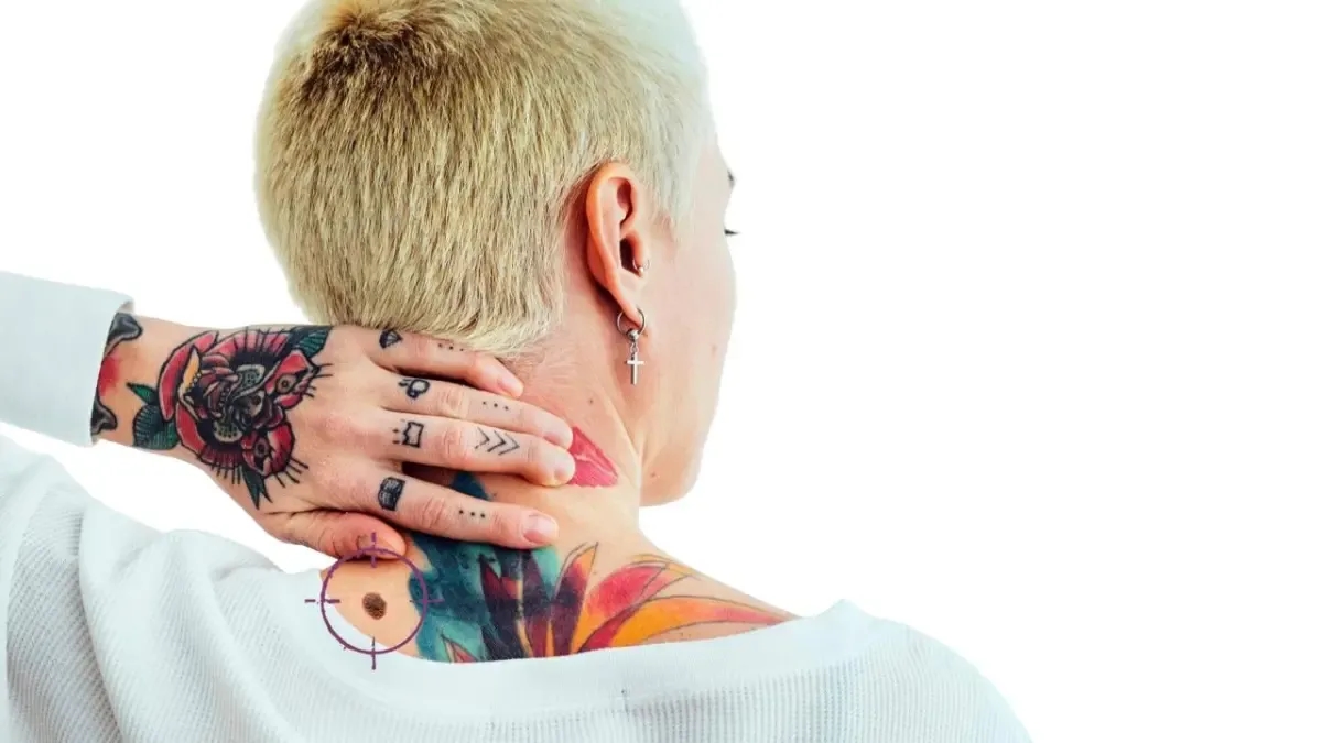 Tatuatori: i nuovi alleati per la diagnosi precoce del tumore della pelle