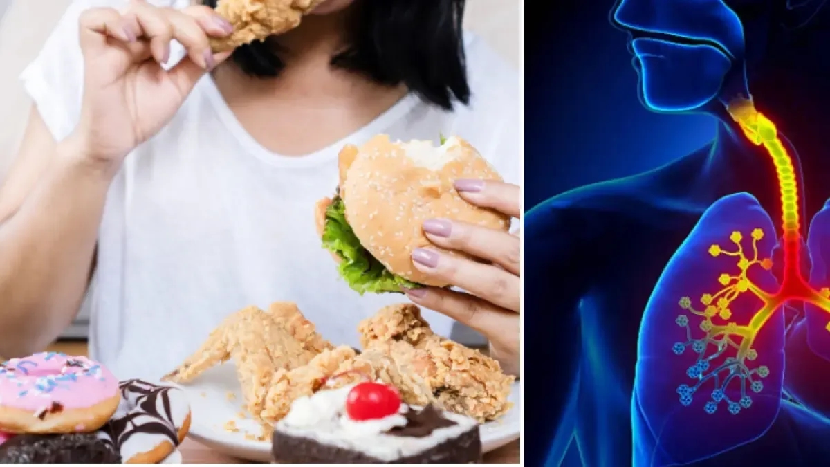 Yeni bir çalışmada, ultra işlenmiş gıdaların tüketiminin akciğer kanseri riskini artırdığı ortaya çıktı