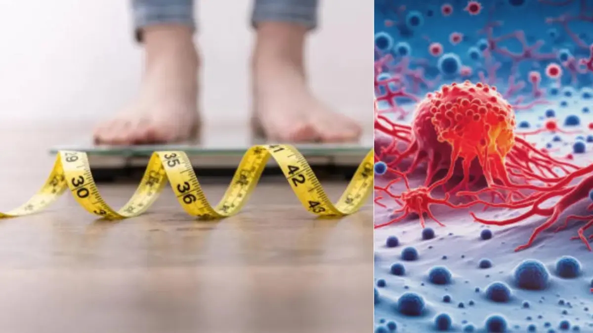 Perdere peso può prevenire fino a 13 tipi di cancro, secondo studi scientifici: ecco l'impatto sulla salute, spiegato dagli esperti.