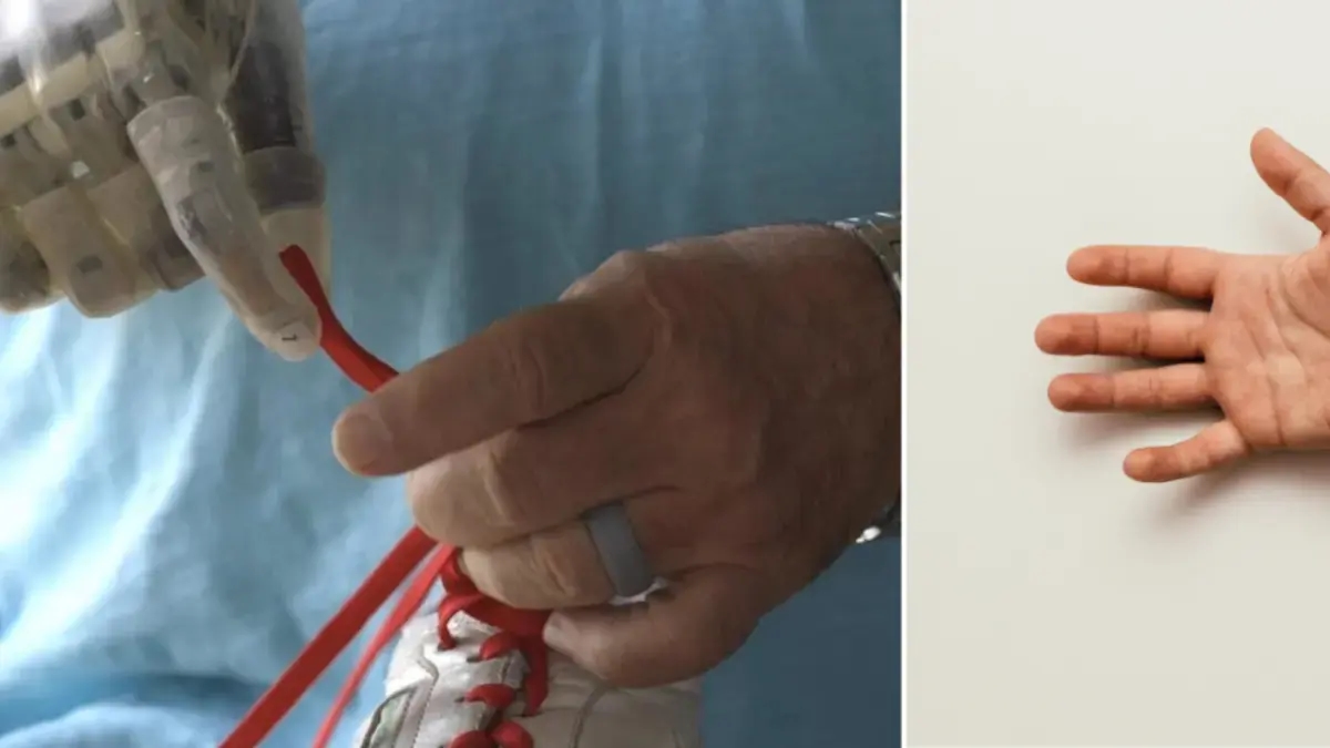 I ricercatori sviluppano protesi sensoriali per le persone con amputazioni degli arti superiori: potrebbero ripristinare il senso del tatto.