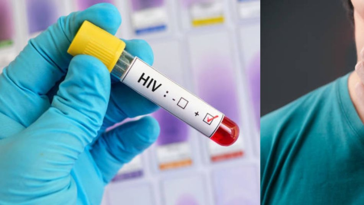 Boğaz ağrısı HIV'in erken bir belirtisi midir? Mayo Clinic, bunun ilk viral yük ile ilişkili olup olmadığını açıklıyor.