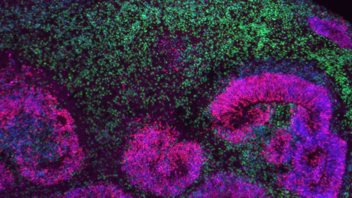 La mappa più grande del cervello in via di sviluppo rivela le fasi in cui hanno origine i disturbi neurologici