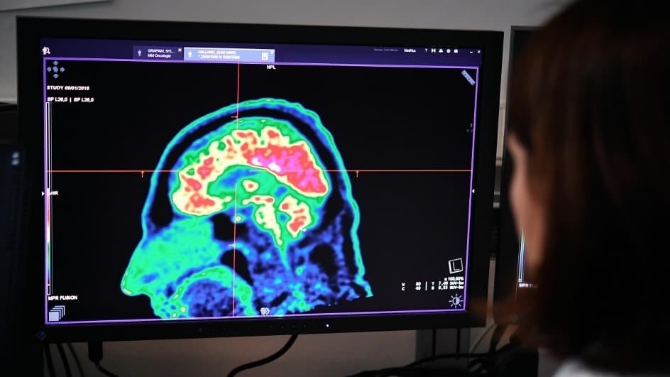 Resultados prometedores: una nueva vía para tratar la depresión mediante ultrasonidos