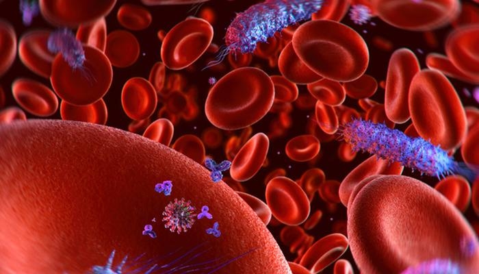 Die Ursache für jeden fünften Todesfall: Sepsis! Was ist eine Blutvergiftung?