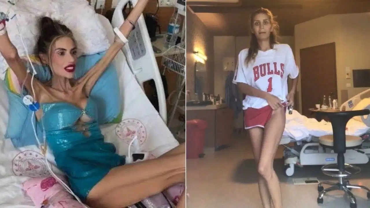Auch İrem Derici erlebte die gleiche Krankheit: Sie erzählte von diesen Zeiten nach Nihal Candan