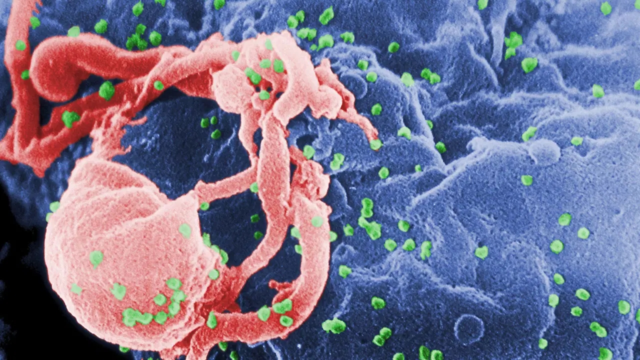 Une étude menée en Turquie a révélé qu’une personne sur trois vivant avec le VIH souffrait de syphilis.
