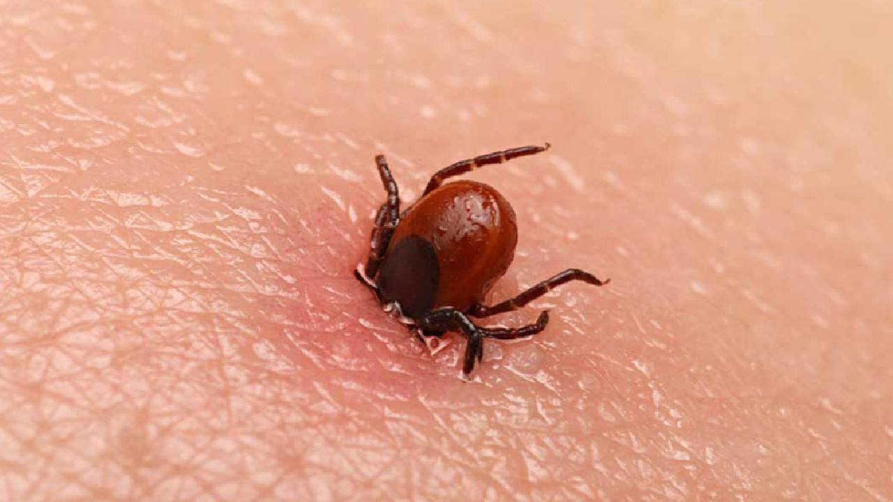Vorsicht Zecken! Was tun gegen vermehrte Zeckeninfektionen in den Sommermonaten?