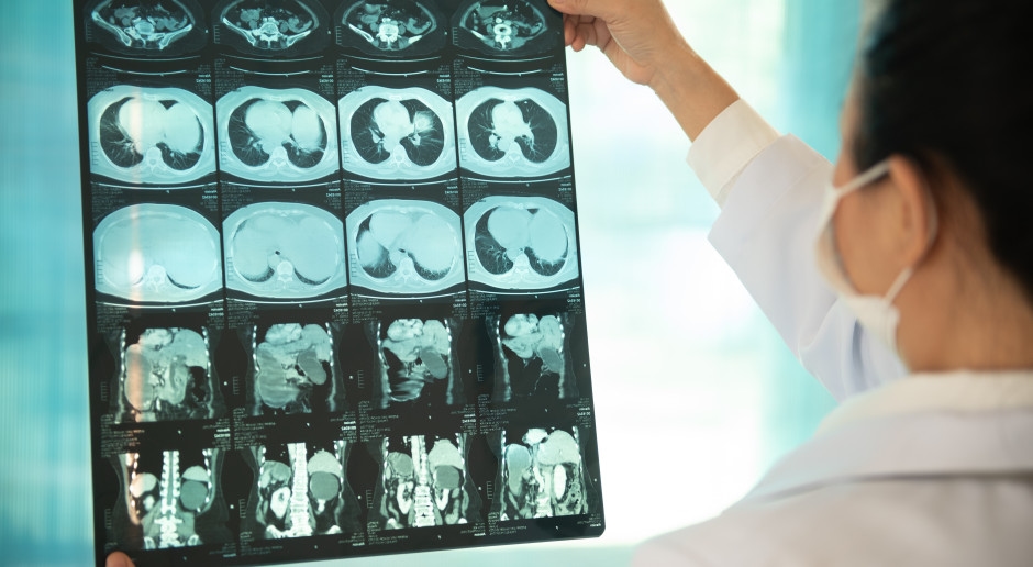 A New Factor That's Driving Your Liver to Ruin: The Hidden Threat