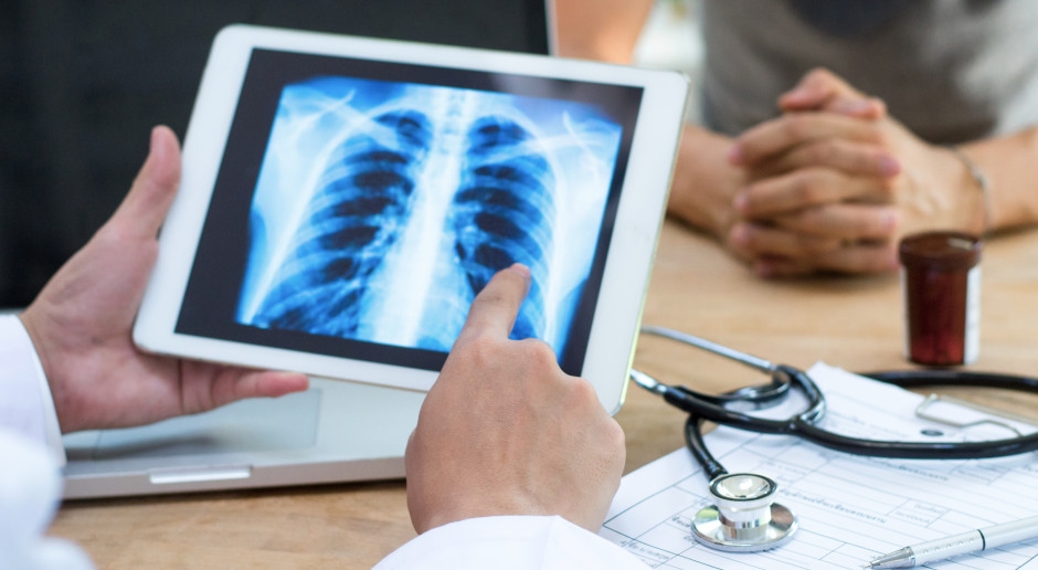Lung cancer revolution: experts reveal details of breakthrough therapy