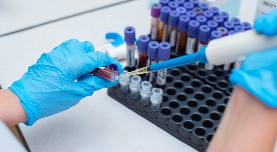 Najgorsza epidemia od lat. Tysiące chorych, dziesiątki zgonów