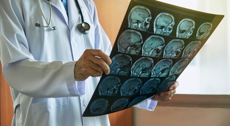 Depósitos cerebrais são apenas parte do quebra-cabeça. Descoberto o elo perdido na doença.