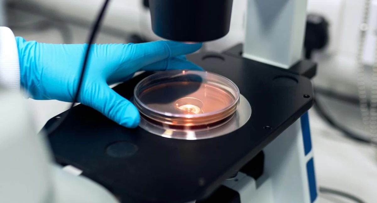 Inteligência Artificial a Serviço da Oncologia: Fragle Detecta Câncer Antes que os Exames o Mostrem