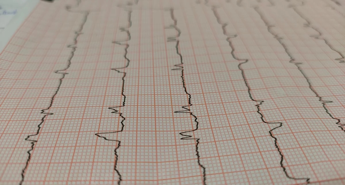 Ministério da Saúde vai padronizar atendimento cardiológico