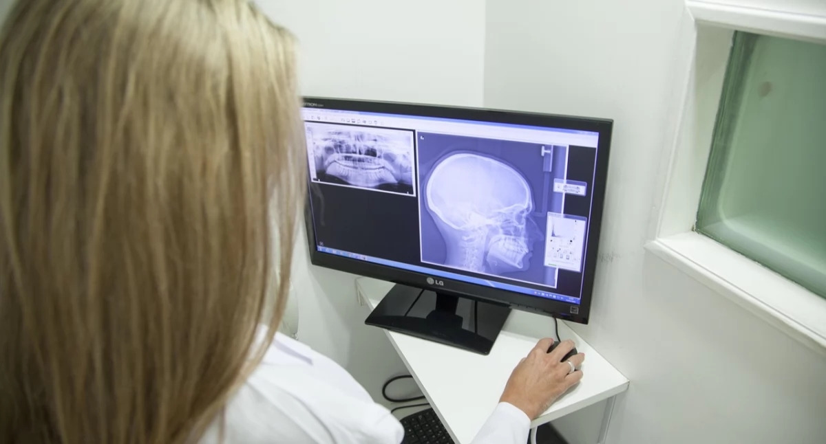 Un nuevo ARN ayuda al cáncer oral a sobrevivir a la quimioterapia, descubren científicos chinos