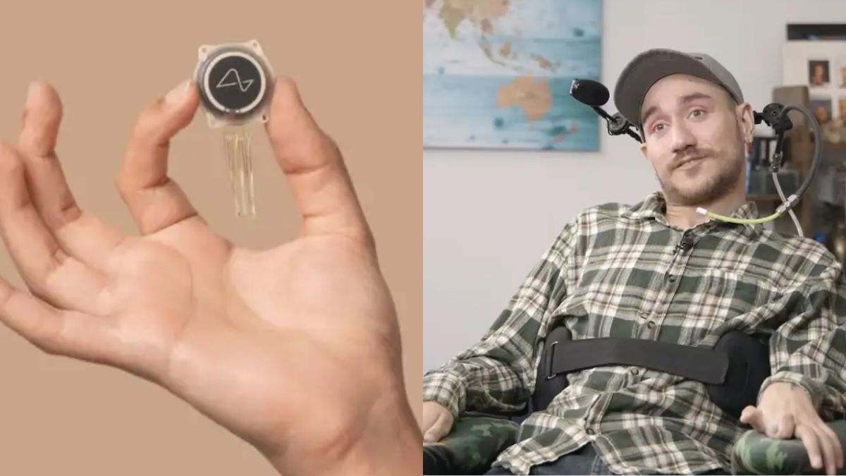O homem cujo chip cerebral foi implantado por Musk mostra como está 18 meses depois: "Não deveria ser possível..."