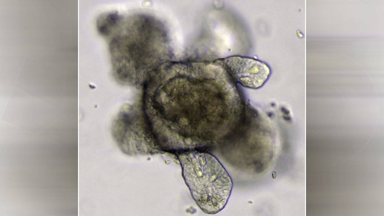 Petits organes, grands espoirs