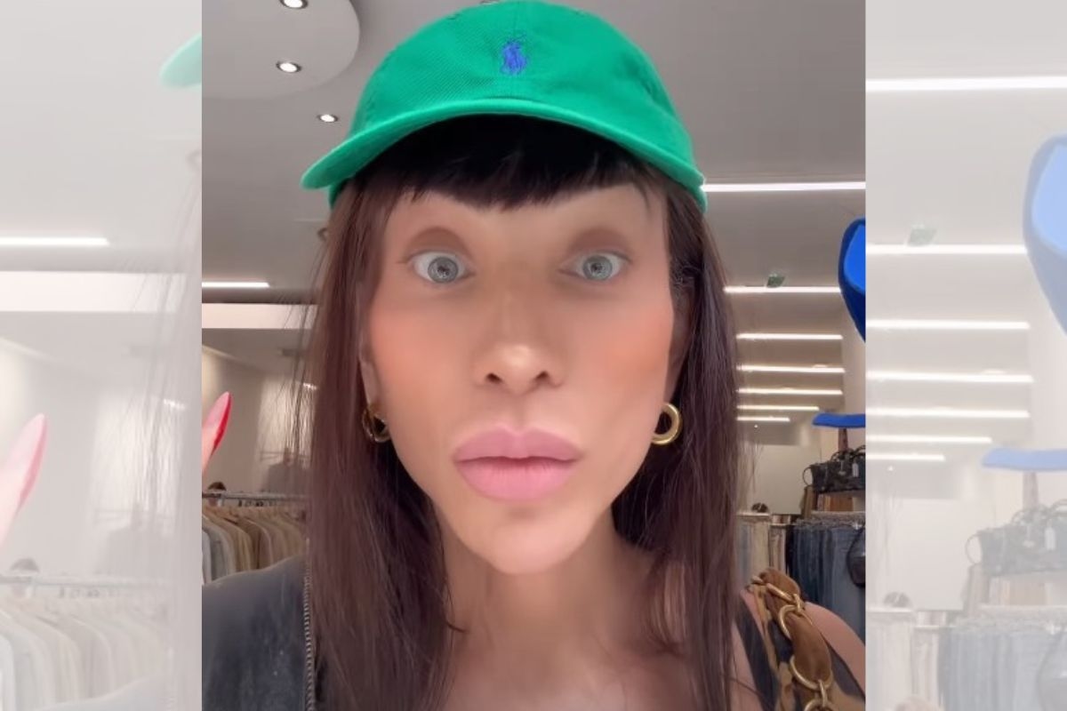 Doctor warns of the risk of changing eye color, like Maya Massafera