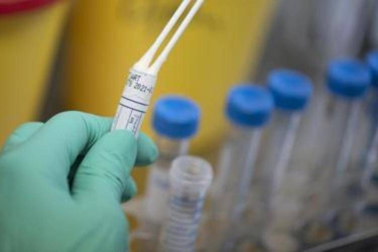 Legionella em habitação social de Milão, um morto e vários hospitalizados