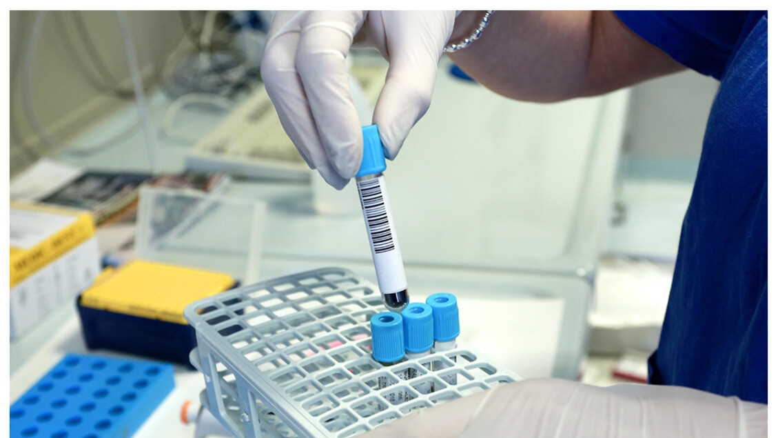 Malattie rare, 100 progetti per il bando Aifa sulla ricerca indipendente