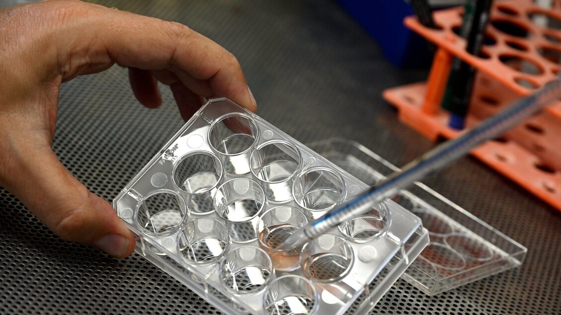 A breakthrough in ALS diagnosis, a study between Turin and the US