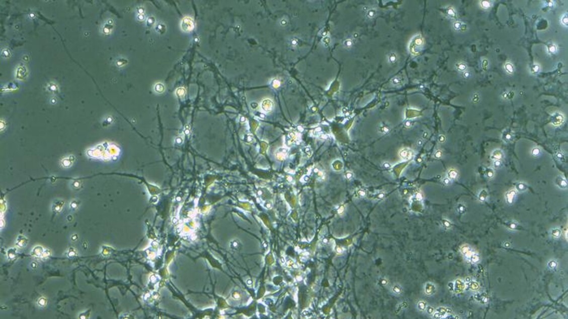 Eine Genbank mit 63 Mutationen zur Erforschung von Autismus