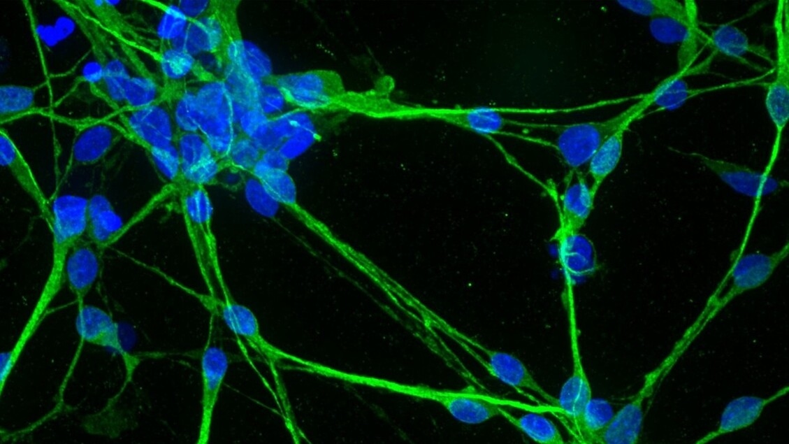 Des organoïdes imprimés en 3D pour la médecine personnalisée du futur