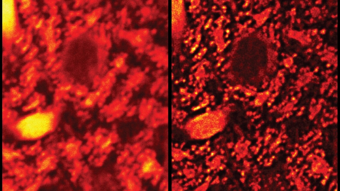 Células Super-HD gracias a un bisturí de luz