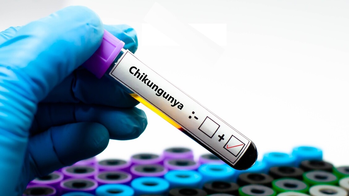 Chikungunya, in Italia negli anni centinaia di casi autoctoni