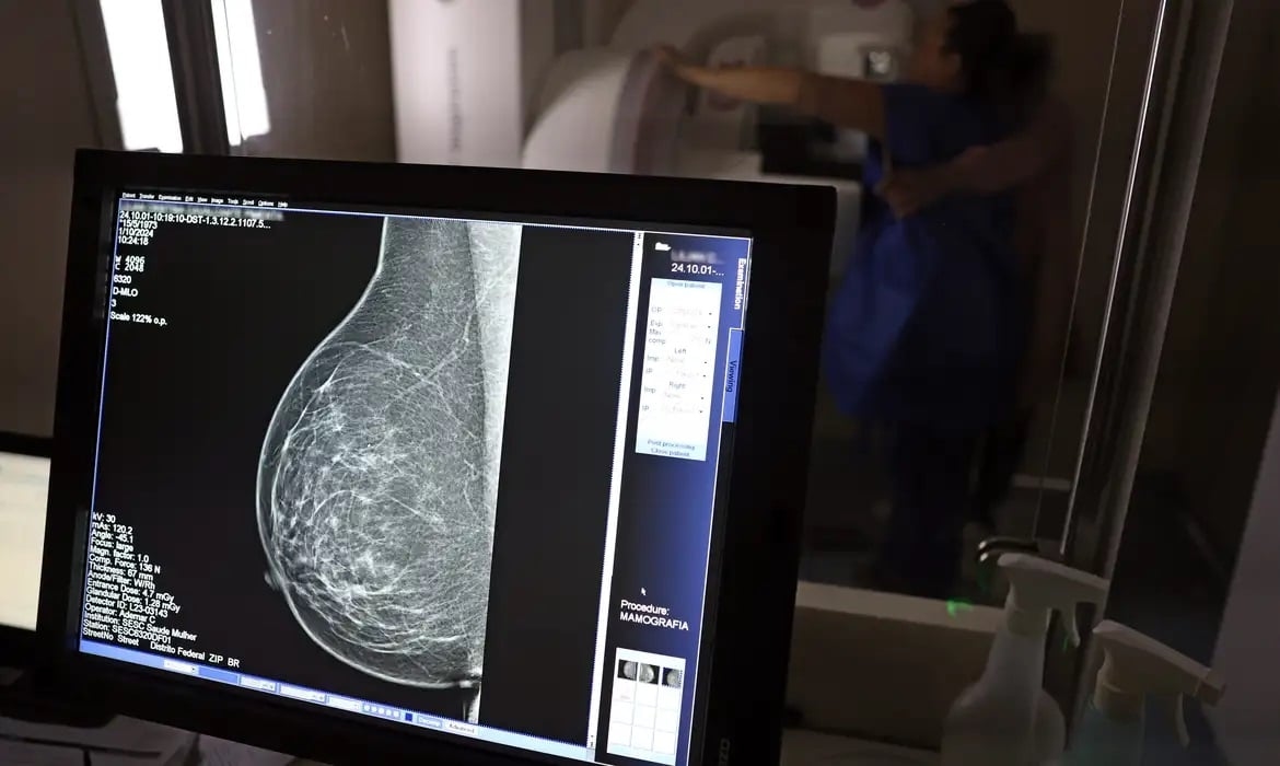Sağlık Bakanlığı artık 40 yaş ve üzeri kişilere mamografi öneriyor