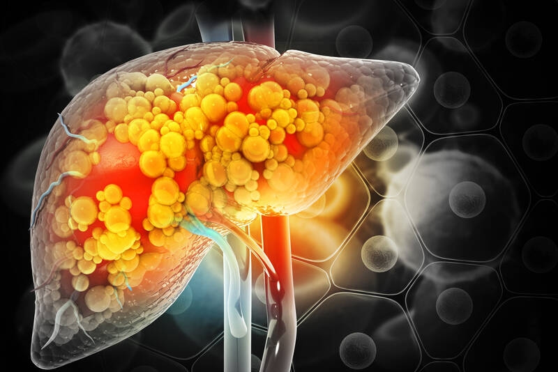 Resmetirom: via libera al primo farmaco contro la fibrosi epatica