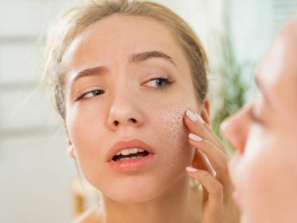 Pelle squamosa e occhi secchi: la carenza di questa vitamina può rovinare il tuo organismo